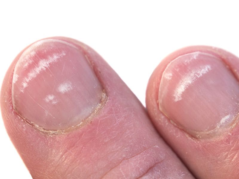 Leuconiquia nas unhas tem algum significado espiritual