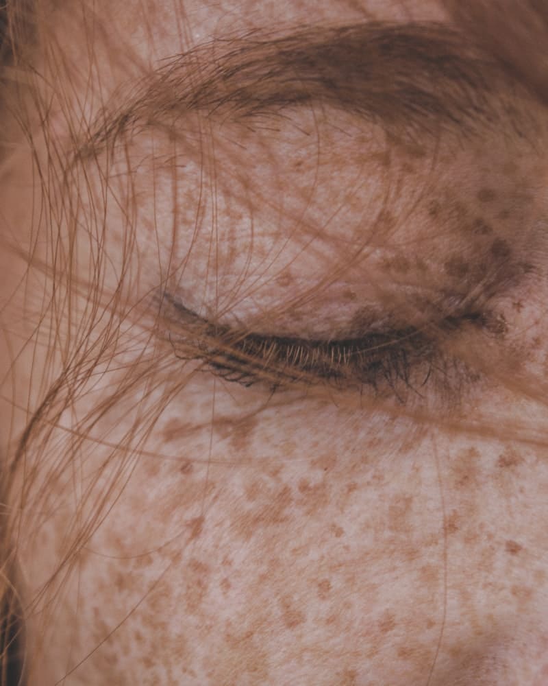Significado espiritual do melasma